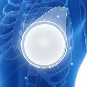 wbmribreastimplantmri